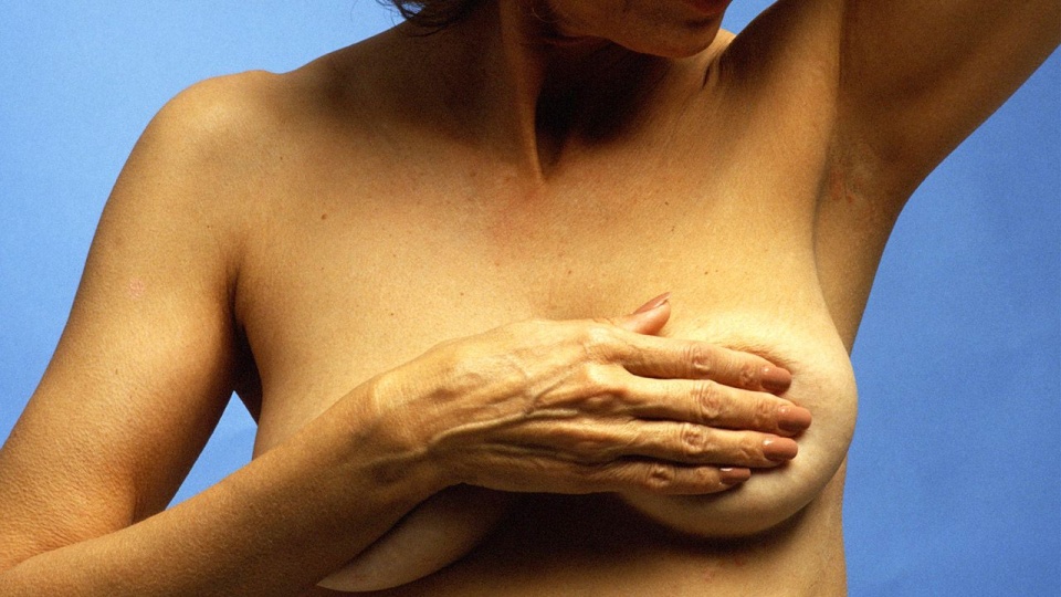 Nowotwór piersi dotyczy co dziesiątej kobiety. /fot. archiwum PAP