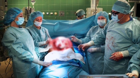 Operacja w szpitalu w Grudziądzu/fot. Regionalny Szpital Specjalistyczny w Grudziądzu, Facebook